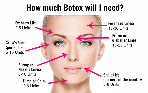 botox pic for website